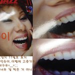 이에 고춧<b>가루</b>..인순이의 실수?