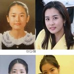 성형<b>수술</b>의 결정판
