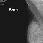 이지혜 x레이..이지혜 x레이 가슴찰영 필름!!