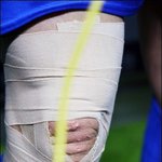 '나의 투쟁'…송종국 무릎사진 '눈길'