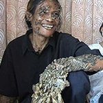 세상엔 이런일도 있구나..나무인간 발견!!?