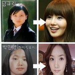 <b>성형</b>하나만으로도 대박난 연예인들!