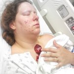 <b>핏덩이</b>도 포기 못한 그녀..엄마이니까