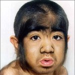 현실에 존재하는 <b>늑대</b>인간..평생 털을 달고사는 사람들!