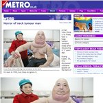 17년만에 목둘레 튜브 벗는 아저씨