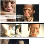 점점 <b>백인</b>으로 변해가는 흑인남자, ㄷㄷㄷㄷ