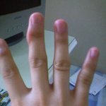 이런 손 보신적 있으신가요?(사진有)