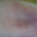 ★버스에서 억울하게 떨어졌어요(사진有)