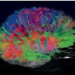 화려한 추상화? 처음 보는 ‘뇌’의 이미지