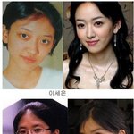 스타들은 다 성형발? <b>희망</b>을 주는 과거사진들!