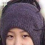 <b>눈</b> 하나로 사람 완전 달라진 려원, <b>수술</b>하길 잘했네~