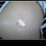 배 쏙 들어가는 약 어디 없나요ㅠㅠ? 살려주십쇼ㅠㅠ