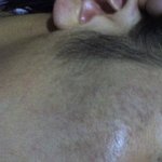 20대중반/남자/★<b>기미</b>★..문제 ㅠ.ㅠ 사진첨부)