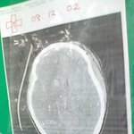 무슨 <b>상태</b>인지...