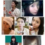 정시아 4<b>차원</b>된 원인은 뒤통수때문-?