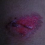 자전거타고오는데 죽을뻔했어여 사진-<b>ok</b> 징그러움