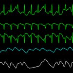 오늘 하루도 참 고단하네여