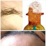 탈모로 고민하는 젋은이들이여~!나도 고민중이다.ㅋㅋㅋ