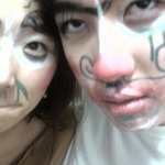 남자친구랑 놀다가 얼굴이 이 지경ㅋㅋㅋ -사진有