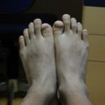 특이한 ? <b>손톱</b>발가락가진 19세 男