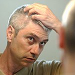 탈모의 <b>원인</b>과 증상