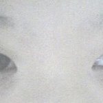 저 성형 수술 했는데 이렇게 됬어요^^ (사진有)