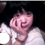 저 쌍수했는데 이렇게 됐어요 ㅠ_ㅠ<사진有>