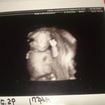 엄마<b>뱃속</b>에서 아가가 有