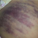 피해 아동의 학부모에게 <b>욕설</b>과 협박문자 보낸 폭행교사 복귀