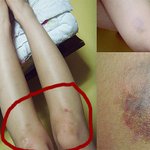 가만히있는 <b>트럭</b>에 치였습니다(사진有)