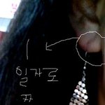 [사진有]귀찢어졌어요 이거 어떻게해야되요?재생가능?