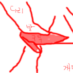 <b>홍대</b> 뒷빡치기 사건...(픽쳐 有)