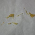 징거버거먹다가 고기에서 뭐 나왔어요 사진첨부해요~