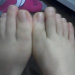 [사진有] <b>두</b>번째발가락이 <b>날</b>이갈수록 길어져요