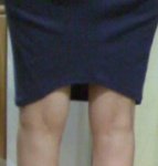 다리 휜 분들.. 혹은  <b>교정</b> 노력하신 분들...ㅠㅠ (사진 有)