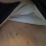 [사진有]명동 한복판에서 남친과 피터지게 싸웠습니다.;;;;;;;;