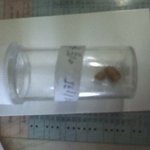 역시 아프면 큰병원을 가라는말이 맞군요...