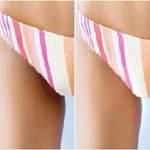 주름,<b>미백</b>,주근깨 관리합시당