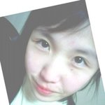 앞트임<b>전</b>vs앞트임후<b>쌍수</b>도다시(붓기가라앉음)