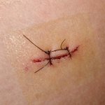 베트남 살인미수사건(사진有)