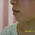 <b>돌출</b>입 교정을 해야할지 ...앞니 성형을해야할지 ..