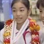 <b>치아</b> 교정의 힘! 정말 대단하구나