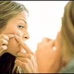 뾰루지 흔적도 없이 사라지게 하는 나만의 노하우