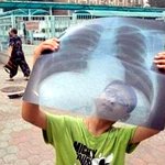 개기<b>일식</b>을 보는 다양한 모습들@