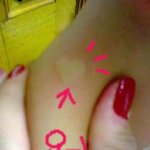 [<b>사진</b>有] 모기가 절 너무 사랑한<b>나머지</b>, 결국