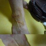 [사진有]고양이한테 난도질 당했어요...