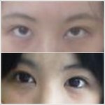<b>써클</b>렌즈뺀 내눈본 내남친..결국차엿어요-사진有