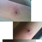 [사진有]<b>팔뚝</b>에이상한게났습니다.이게뭐죠?