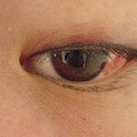 사진有 ...아픈것도 서러운데 병원태도에 화가나네요