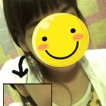 귀(사진有)저는 귀 뚫었다가 귀 찢어졌어요!